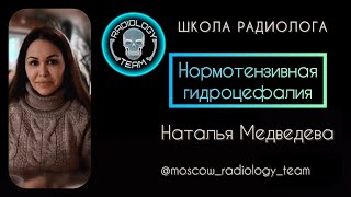 НОРМОТЕНЗИВНАЯ ГИДРОЦЕФАЛИЯ  (НТГ)/НАТАЛЬЯ МЕДВЕДЕВА/MOSCOW RADIOLOGY TEAM