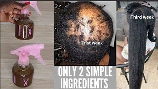 Potent Hair Growth treatment Use Daily Only 3 Ingredients To Grow Bald Hair extremely Faster