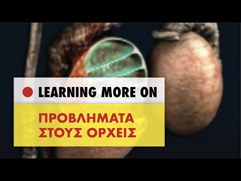 Βίντεο: Ορχις