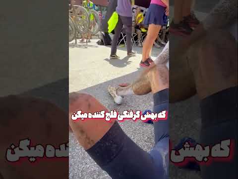 چرا ساق پای این دوچرخه سوار نبض می زند 