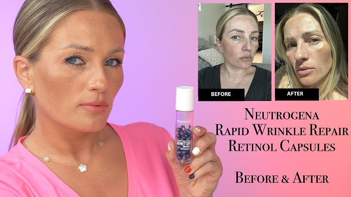 Which Neutrogena product has the most retinol?