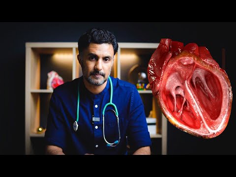 Video: Preoperativ Optimalisering Av Pasientforventningene Forbedrer Langtidsutfallet I Pasienter Med Hjerteoperasjoner: Resultater Fra Den Randomiserte Kontrollerte PSY-HEART-studien