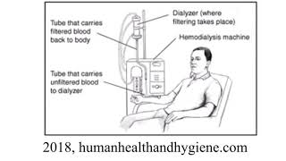 What are Hemodialysis and Peritoneal Dialysis?