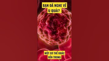 Có một cơ thể khác bên trong bạn, đó là u quái.