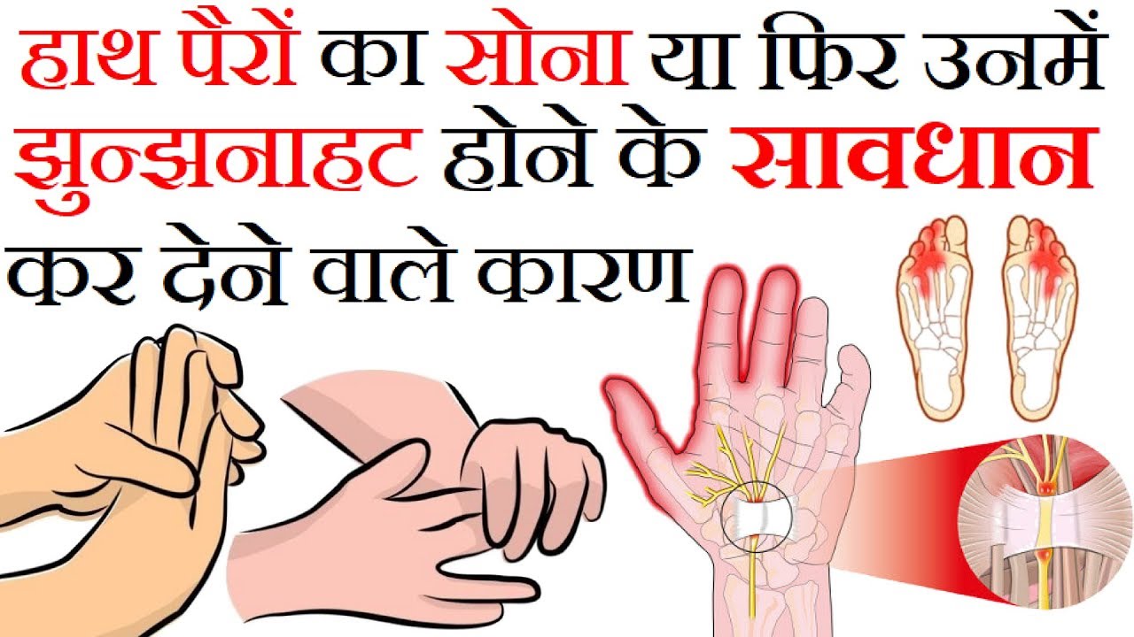 हाथ पैरों का सुन्न होने के चौकान देने वाले कारण Numbness in Hands and