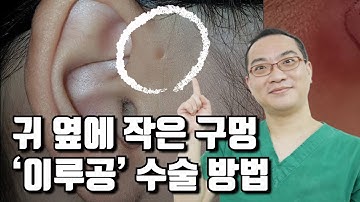 귀 옆에 작은 구멍 