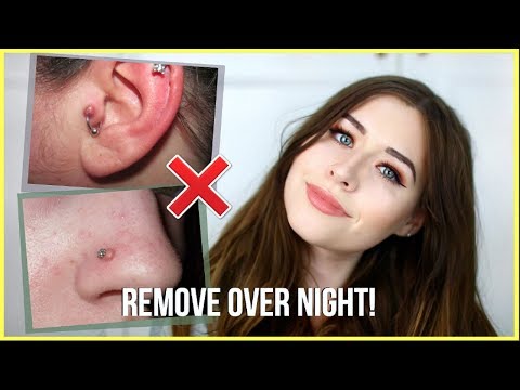 How To Get Rid Of Piercing Bumps OVERNIGHT!