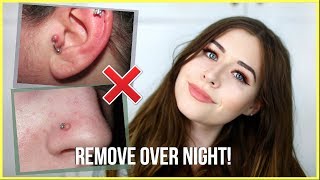 How To Get Rid Of Piercing Bumps OVERNIGHT!