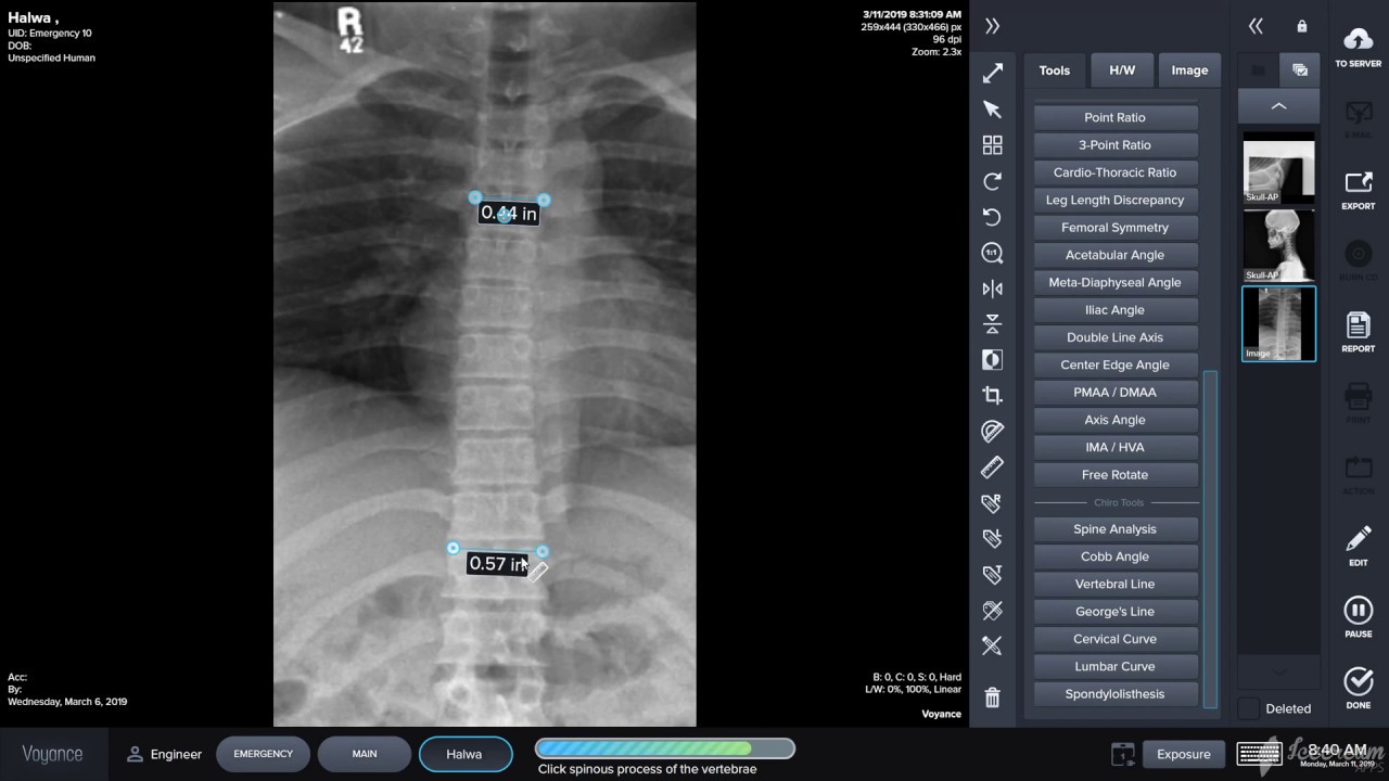 Vertebral Line Chiropractic Tools