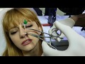 Burun Nose Piercing Sonrası Bakım Ve ÖNERI ??