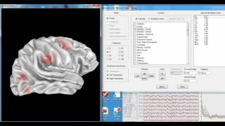 BrainSurfer Network Viewer
