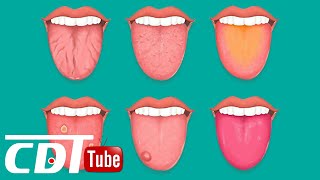 Que dit la couleur de votre langue à propos de votre santé ? | CDT NEWS