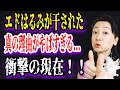 【ゆっくり解説】エドはるみが干された真の理由がやばすぎる...衝撃の現在！！