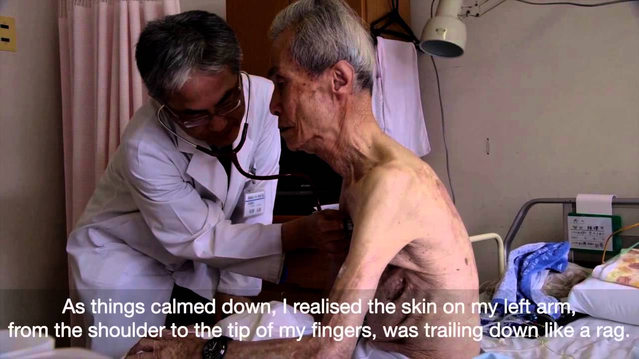 何千人もの被爆者が今も治療中、スイスの赤十字国際委員会が報告 - SWI