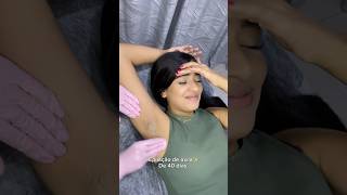 Depilando A Axila Com Cera, Após 40 Dias Çãocomcera