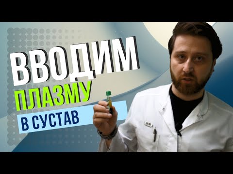 Плазмолифтинг суставов. Как плазма помогает в лечении и восстановлении суставов?