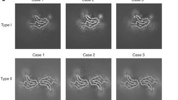 CryoEM Helical Reconstruction in Relion |  Corticobasal degeneration | Empiar-10340 |Part-1