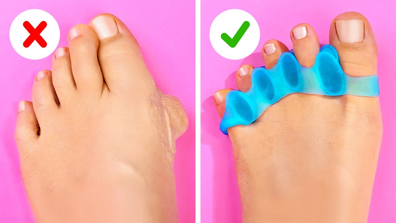 SAVVY GADGETS AND HACKS FOR HEALTHY FEET AND COMFORTABLE SHOES