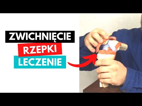 Wideo: Zwichnięcie - Leczenie Zwichnięcia środkami I Metodami Ludowymi