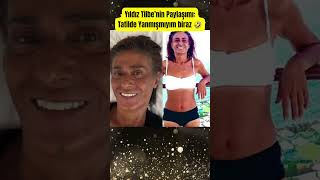 Yıldız Tilbe’nin Paylaşımı: Tatilde Yanmışmıyım Biraz Resimi