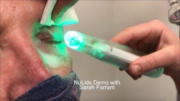 NuLids Demo with Sarah Farrant