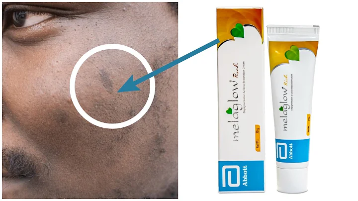 Top 3 BEST Skin Whitening Creams For Men 2025! #skinwhitening #creams #skincare #glowingskin