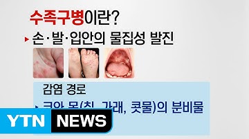 여름철 불청객 수족구병...예방법은? / YTN (Yes! Top News)