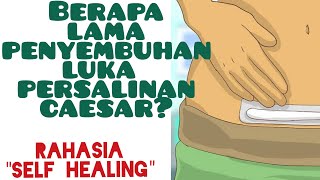 Berapa Lama Luka Jahitan Operasi Caesar (sesar) Sembuh dan Kering 