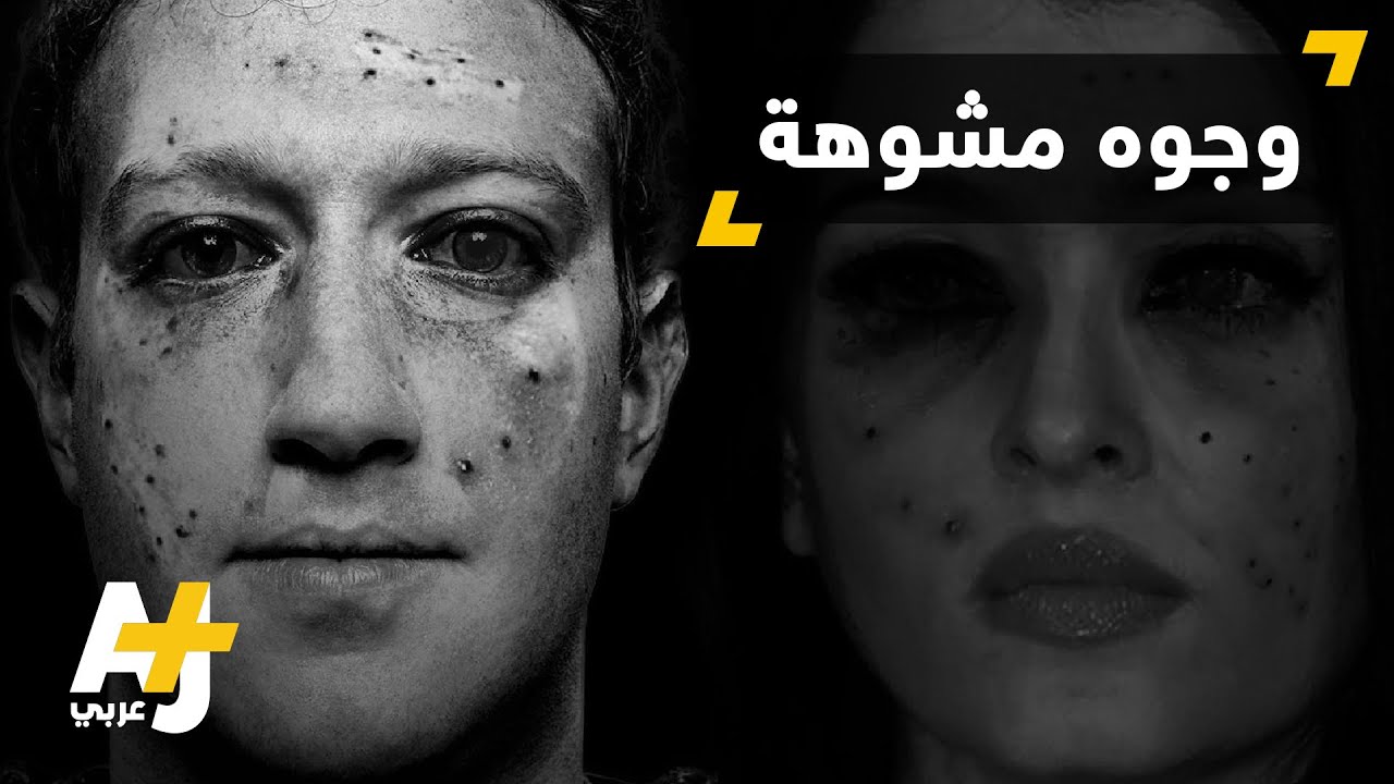 حملة إلكترونية ضد استخدام بنادق الصيد في كشمير