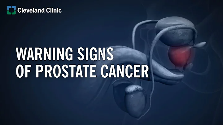 10 Warning Signs of Prostate Cancer - DayDayNews