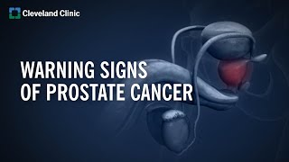10 Warning Signs of Prostate Cancer