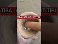 Tiba Asili Ya Utitiri Kwa Kuku