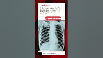 Medical Print Solution For CT MRI XRAY ULTRASOUND