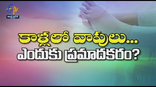Treatment for leg edema | Sukhibhava | 25th April 2022| ETV Andhra Pradesh