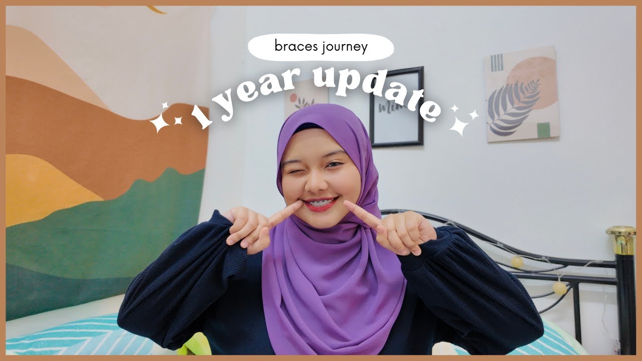 Braces Journey😁 1 YEAR BRACES UPDATE & TRANSFORMATION Malaysia YouTube