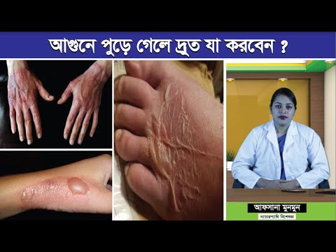 ভিডিও: কীভাবে আগুনে শুদ্ধির অনুষ্ঠান করবেন