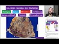 07 - Bactérias e Doenças Bacterianas - Tuberculose