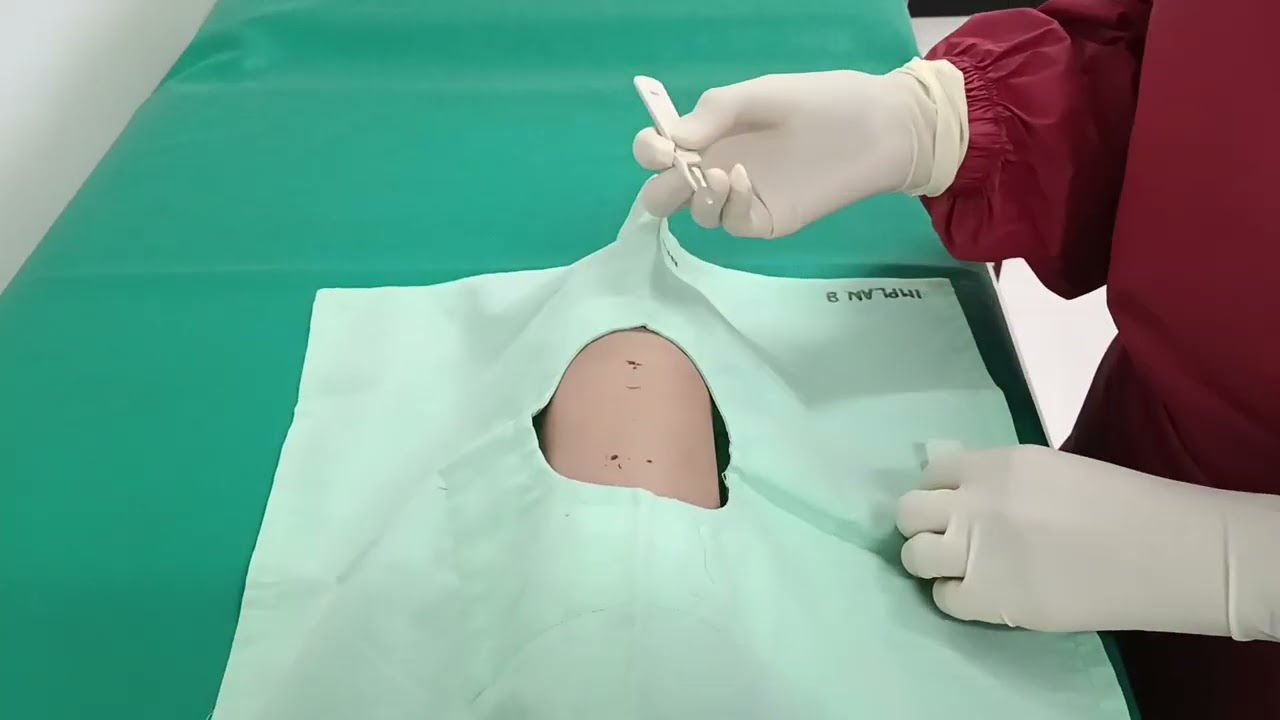 Prosedur Pemasangan & Pelepasan Implan