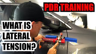 WHAT IS LATERAL TENSION?  PDR