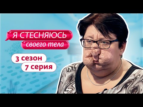 Я СТЕСНЯЮСЬ СВОЕГО ТЕЛА. РОССИЯ 3 СЕЗОН 7 ВЫПУСК