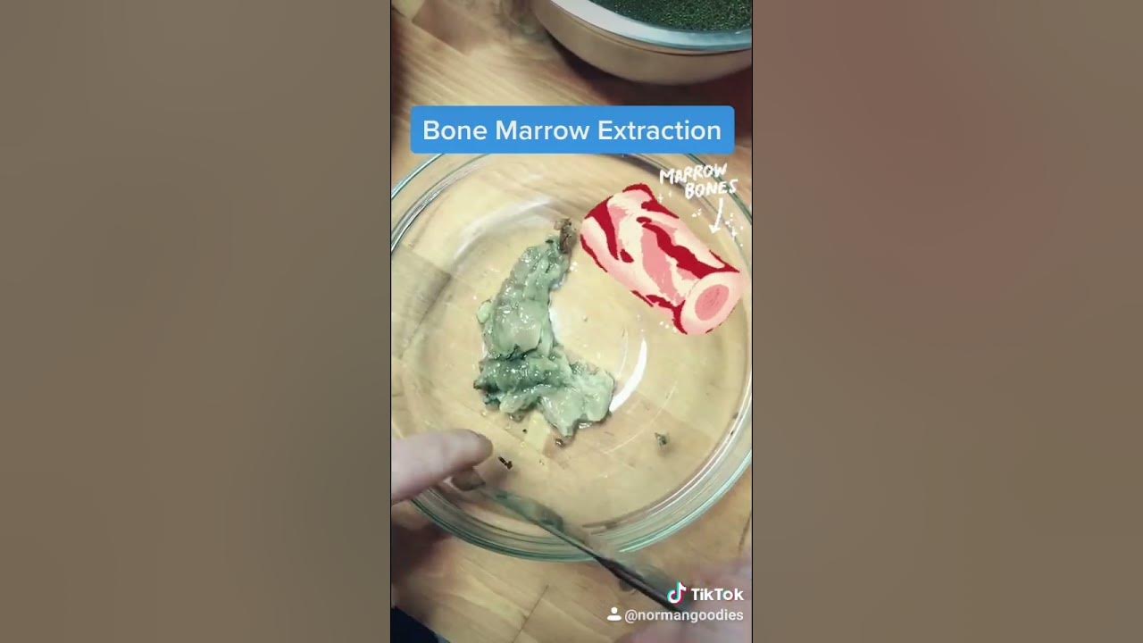 Bone Marrow Extraction method YouTube