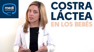 ¿Qué es la costra láctea en los bebés? #MediConsultas