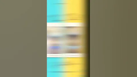 Amazing Liposuction 360 Result🤩 Brazilian Butt Lift Surgery Result 🤩 Cosmetic Surgeon Dr.Moein