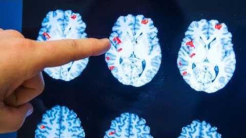 Researchers say there