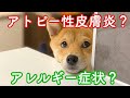 【アレルギー症状】【アトピー性皮膚炎】カイカイの原因は？