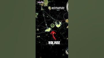 Green Stalked Cell Under Microscope (Volvox and Epistylis)