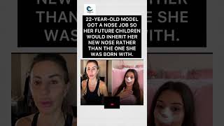 👃😂 Future Kids Nose Upgrade?! 😭🧬#OddlyHorrifying #Rhinoplasty #NoseJob #PlasticSurgery #Genetics