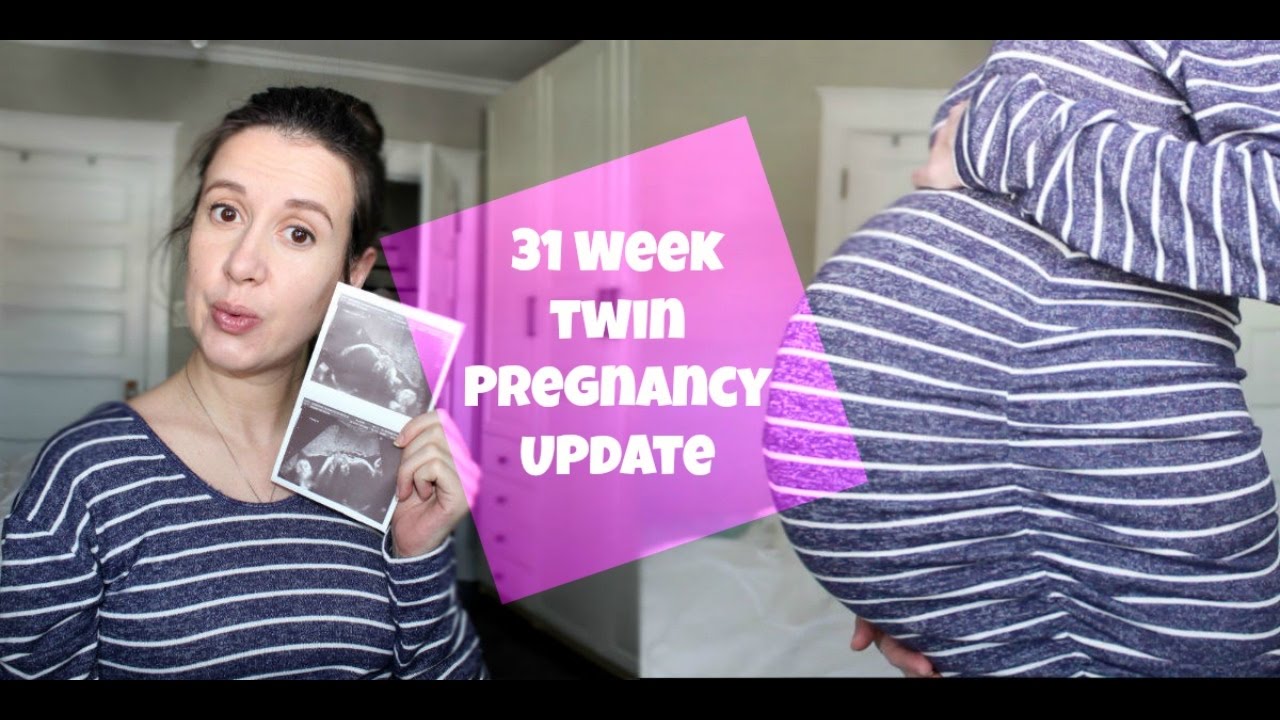 31 Week Twin Pregnancy Update Breech Baby, Csection & Cervix YouTube