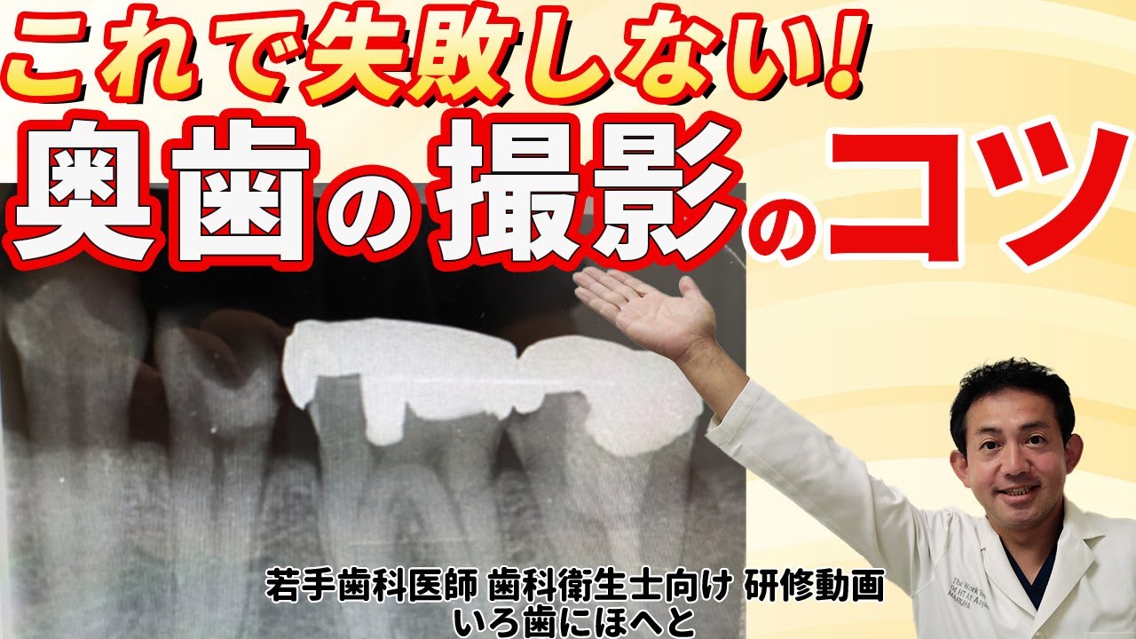 これで失敗しない！下顎7番の根尖までのデンタル撮影のコツ