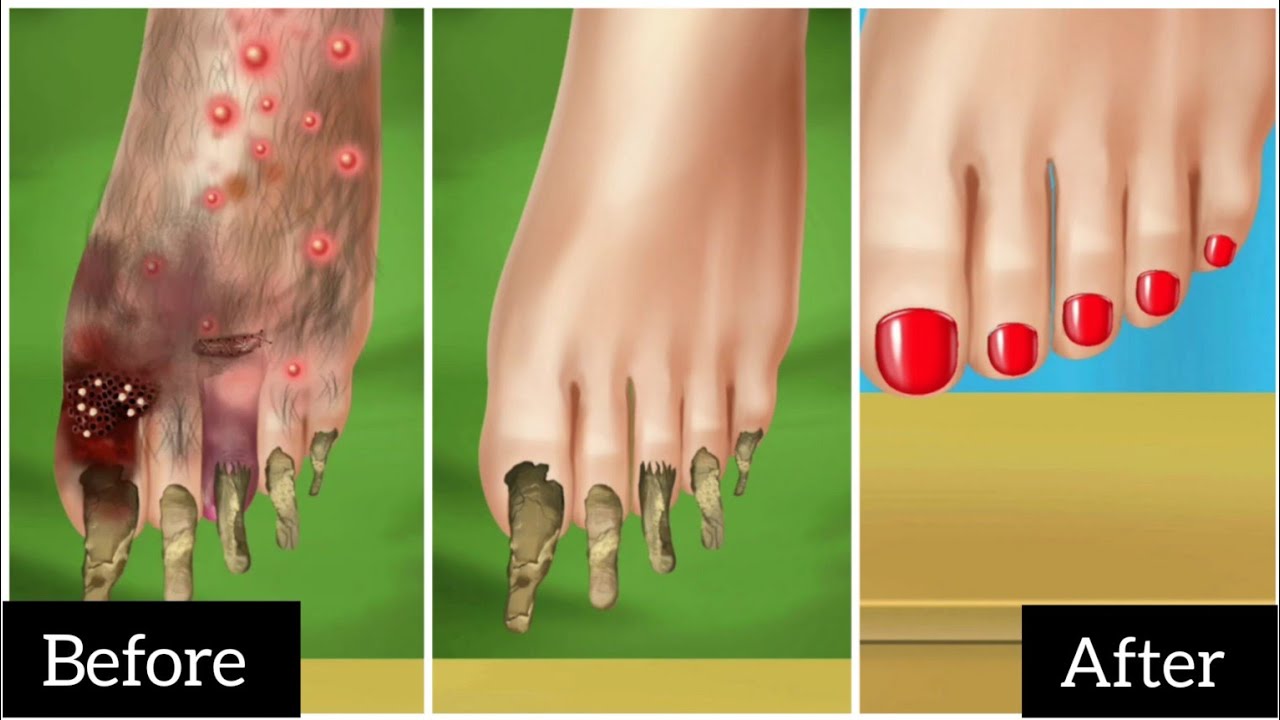 Satisfied Asmr Cleaning treatment YouTube